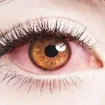 Red and Bloodshot Eyes: