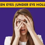 Sunken Eyes